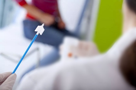 Kemajuan dalam pemeriksaan kanser serviks: Peranan ujian HPV pengumpulan diri
