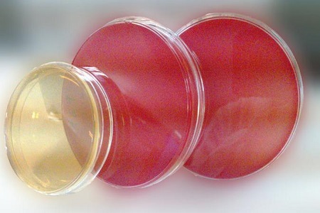 Salmonella Shigella Agar (SS): Medium penting untuk pengasingan patogen