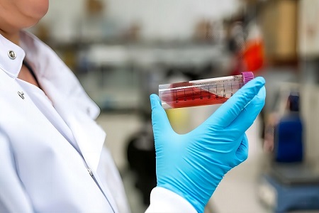 Kit Pengangkutan Virus (Tidak Diaktifkan)-Koleksi Sampel Virus Selamat