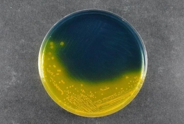 Memastikan Keselamatan Makanan: Babio's Salmonella Shigella Agar (SS) menyokong piawaian pengesanan patogen global