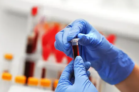 Pengesanan Malaria Rapid: Kit Ujian Antigen Dual Babio Memperkayakan Kesihatan Global