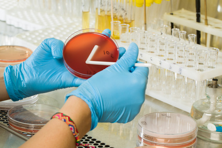 Medium Agar MacConkey BABIO - Pengasingan Selektif Premium untuk Diagnostik Mikrobiologi Global